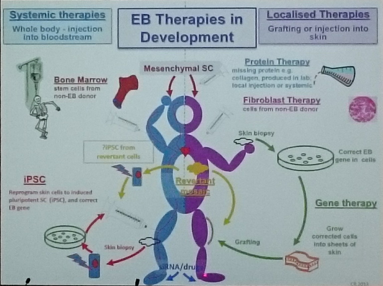 EB的治療發展示意圖